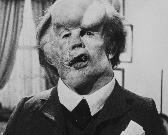 film__2986-the-elephant-man--hi_res-18138c05.jpg